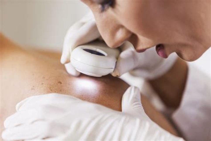 What happens if squamous cell carcinoma is left untreated?