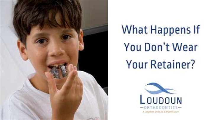 What happens if you don't wear your retainer for 4 months?