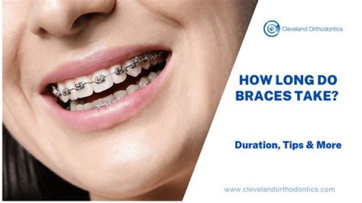 What happens if you leave braces on for too long?