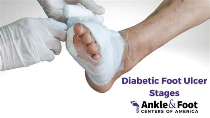 What happens to diabetics feet?