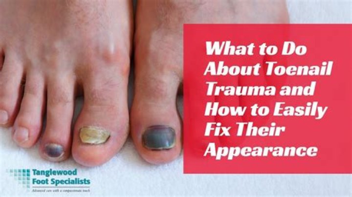 What happens to toenails as we age?