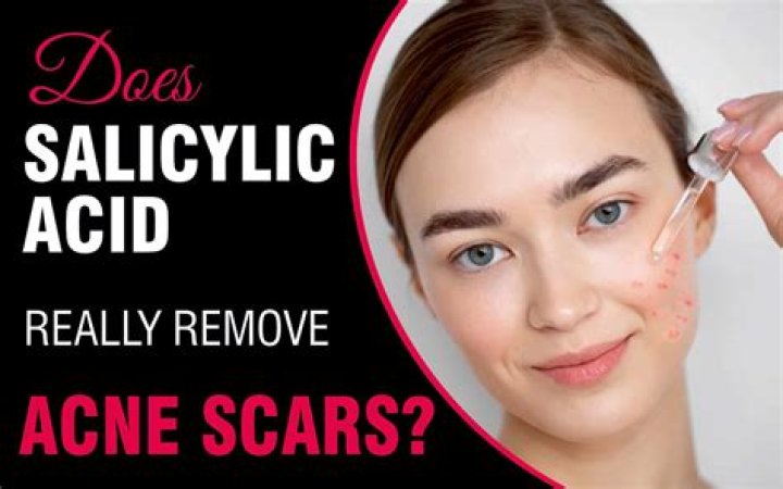 What happens when you start using salicylic acid?
