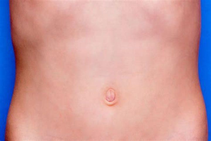 What is a belly stone?