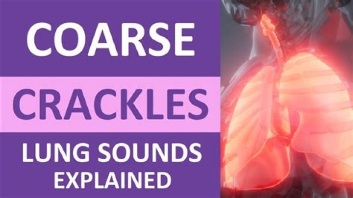 What is a crackle tune?