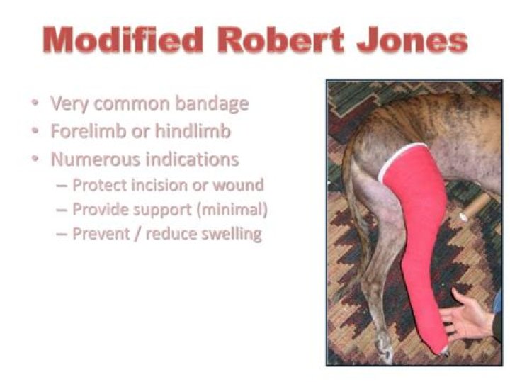 What is a Robert Jones bandage?