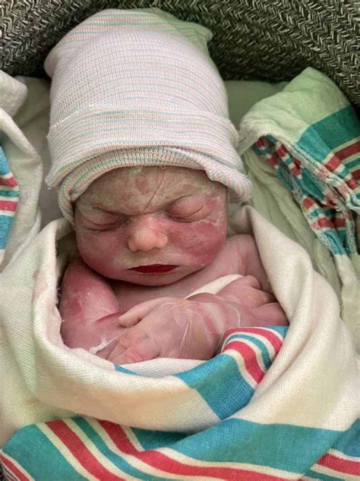 What is a still born?