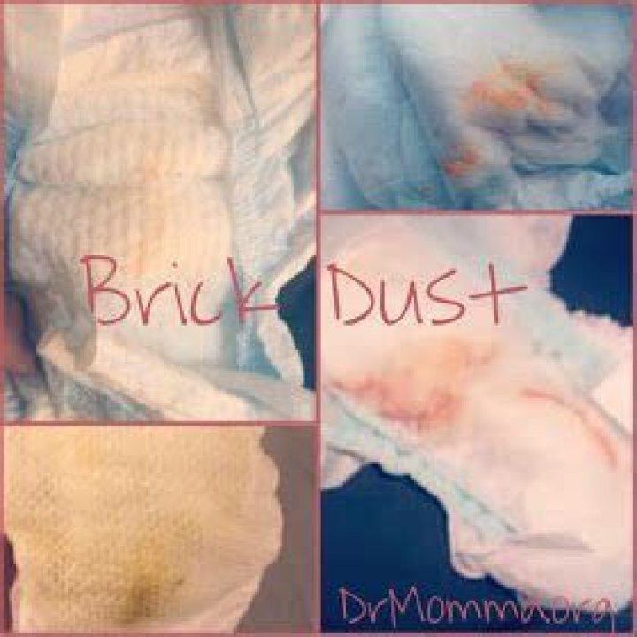 What is brick dust urine?