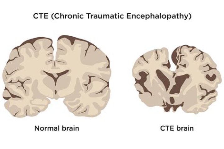 What is CTE?