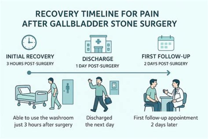 What is forward recovery time?