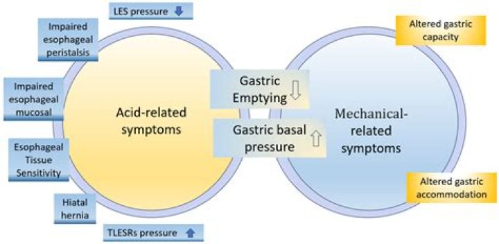 What is GERD anxiety?