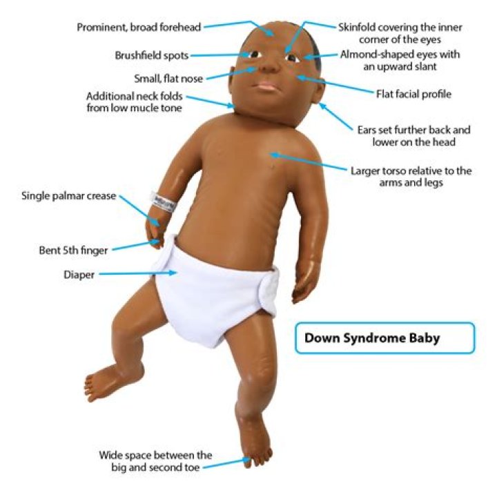 What is last born syndrome?
