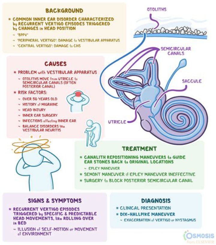 What is sinusitis vertigo?