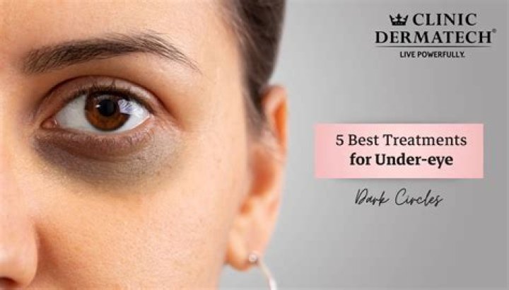 What is the best treatment for under-eye bags?