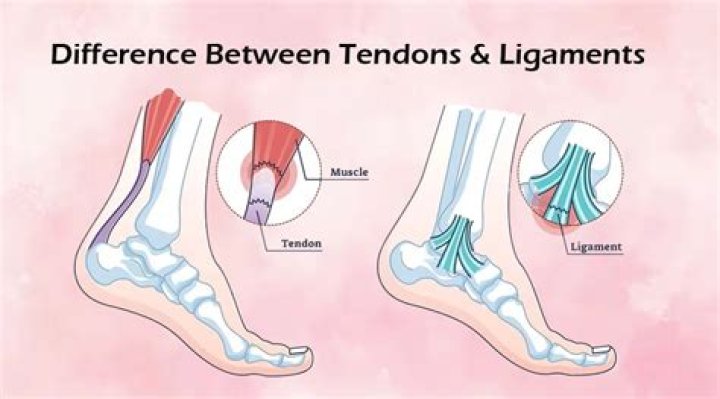 What is the difference between muscle strain and tendonitis?