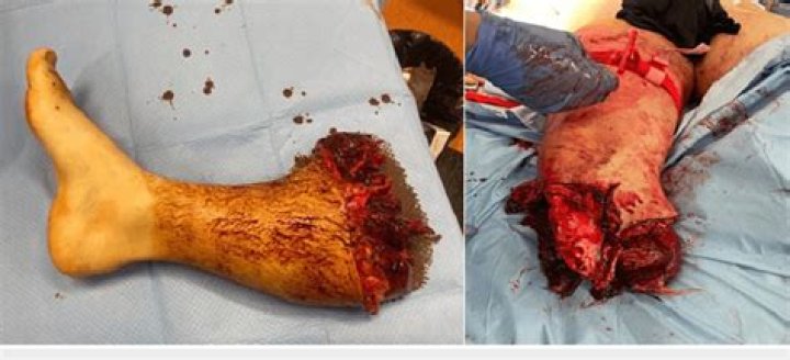 What is the most traumatic job?