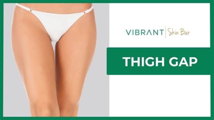What is the thigh gap trend?