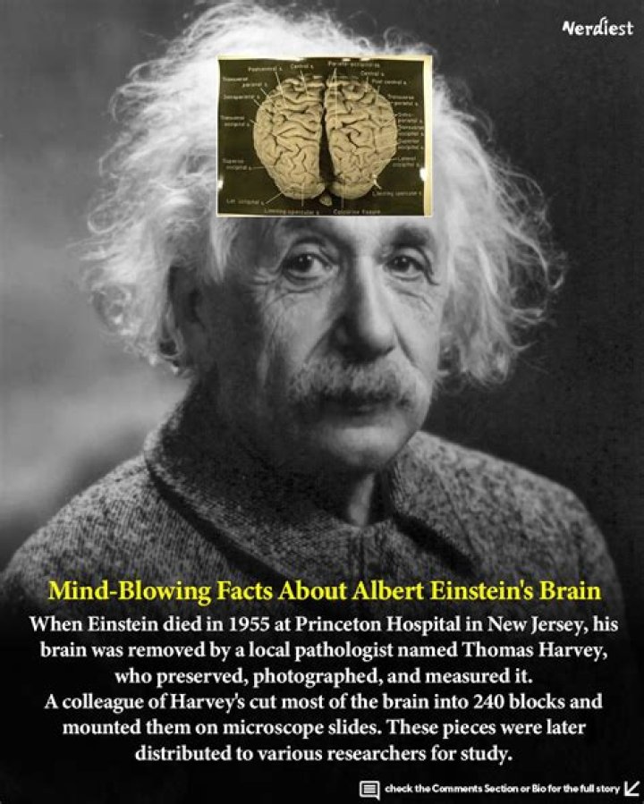 What part of Einstein's brain was missing?