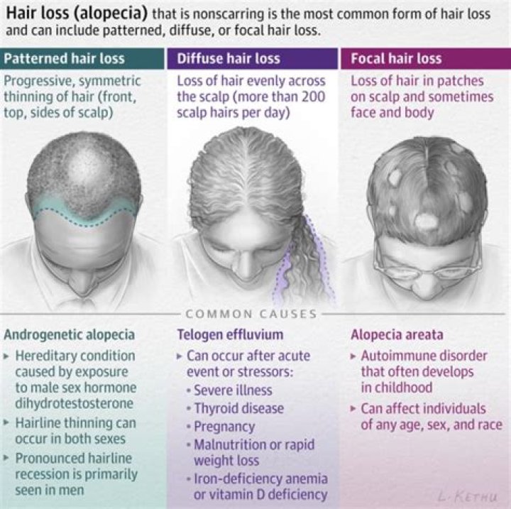 What shampoos can cause hair loss?