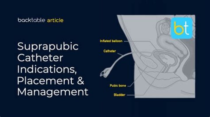 What should you not drink with a catheter?