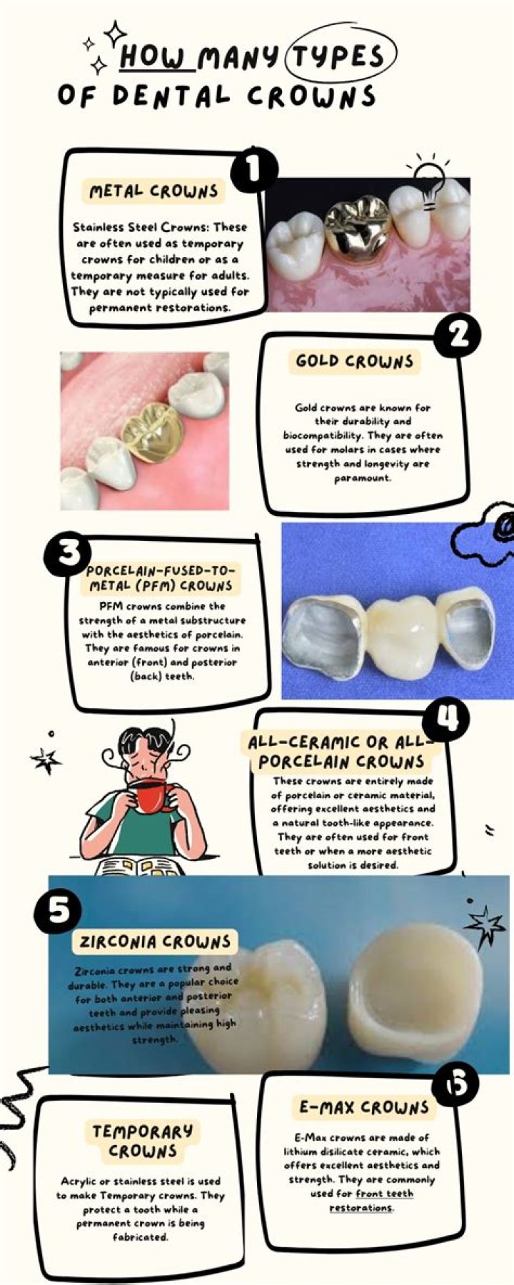 What type of crown lasts the longest?