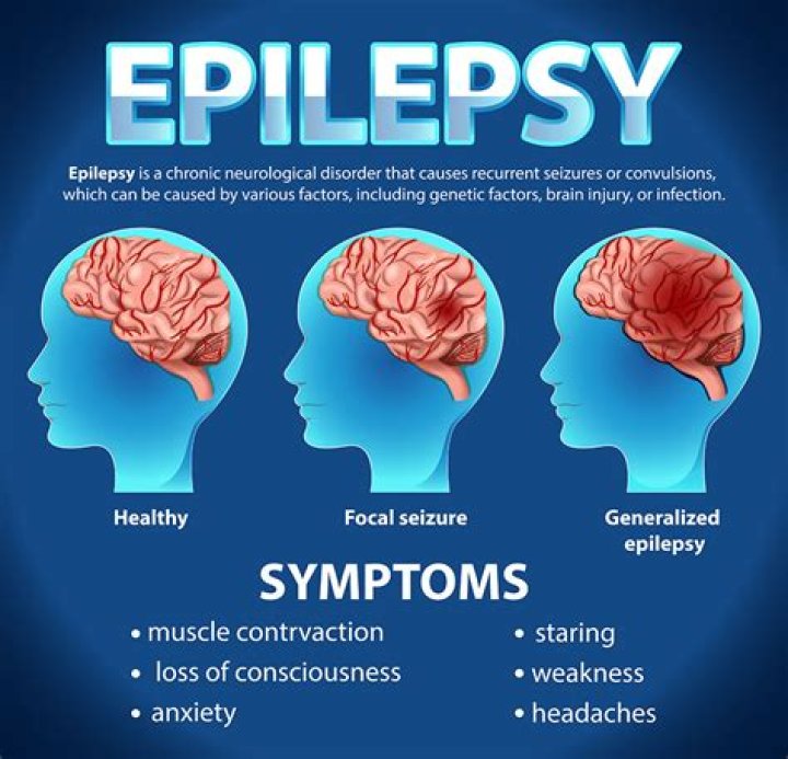 What type of disease is epilepsy?