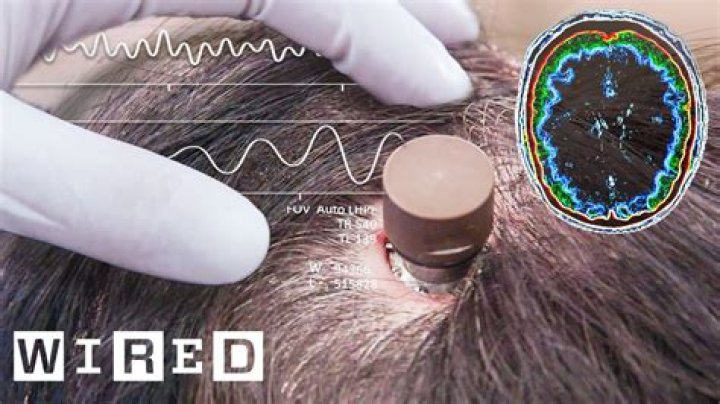 What will Neuralink do?
