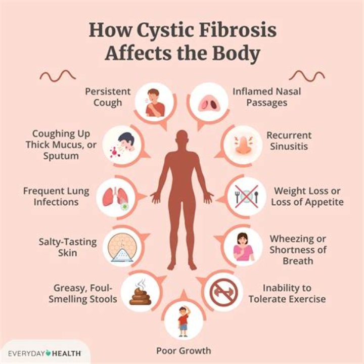 What's the average lifespan for someone with cystic fibrosis?