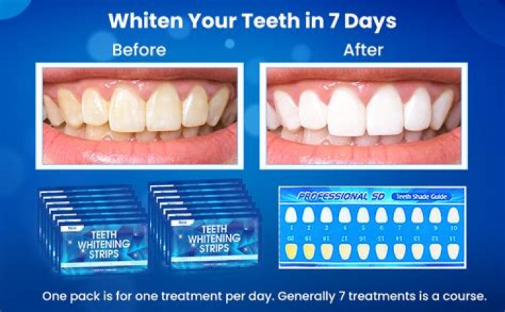 What's the most effective teeth whitening treatment?