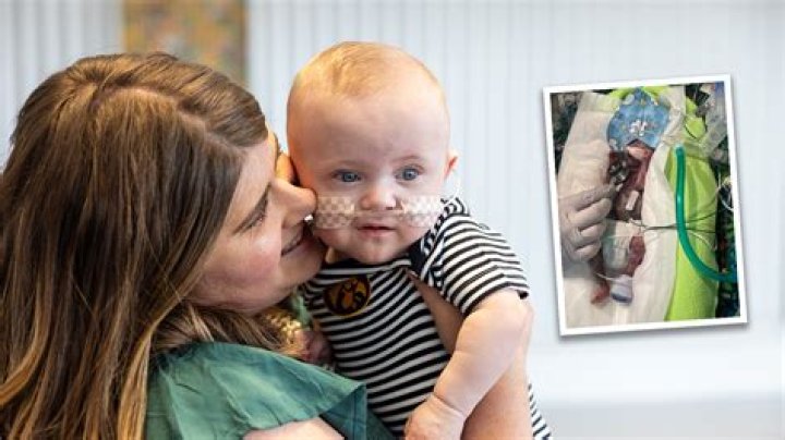 What's the youngest baby to survive?