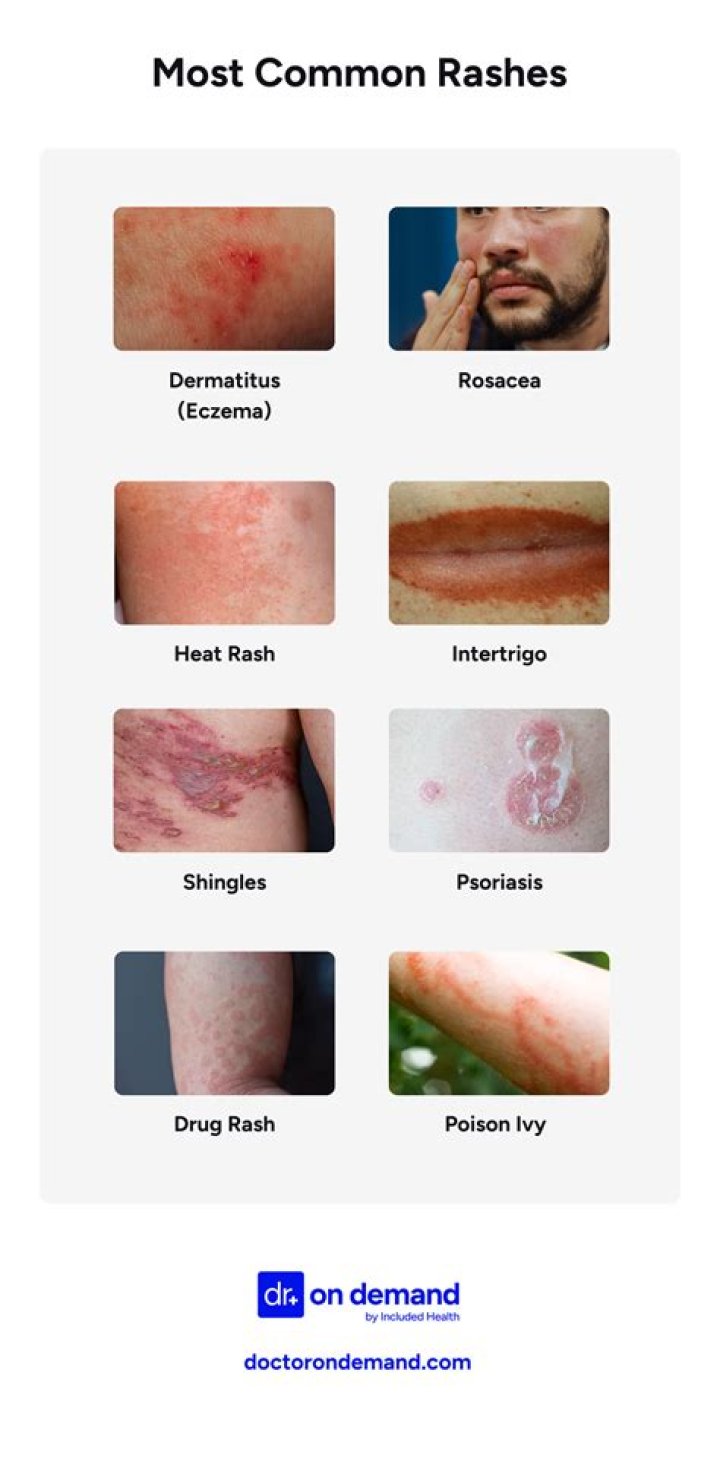 When is a rash serious?