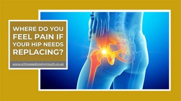 Where do you feel pain if your hip needs replacing?
