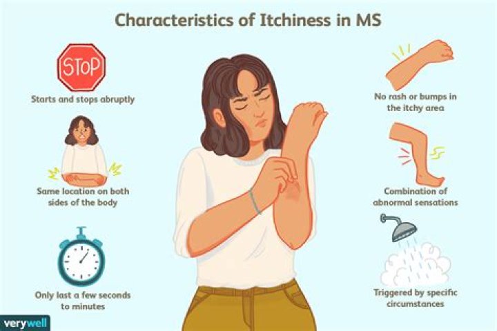 Where do you itch with MS?