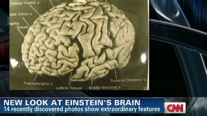 Where is Einstein's brain?