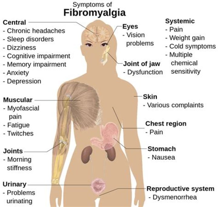 Where is fibromyalgia pain located?