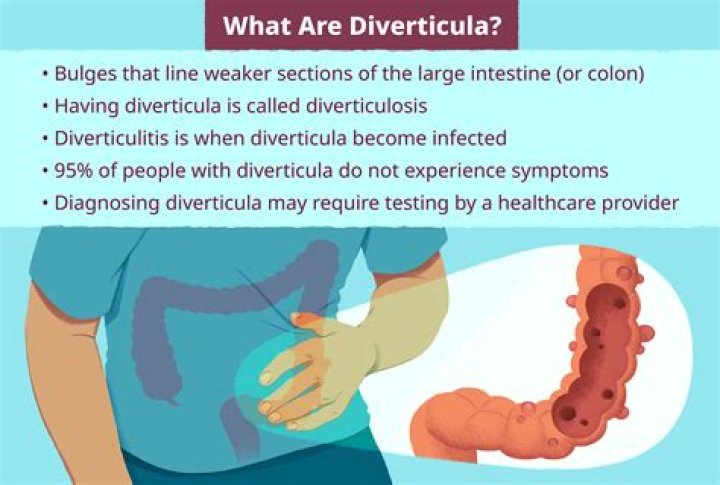 Which is worse diverticulitis or diverticulitis?