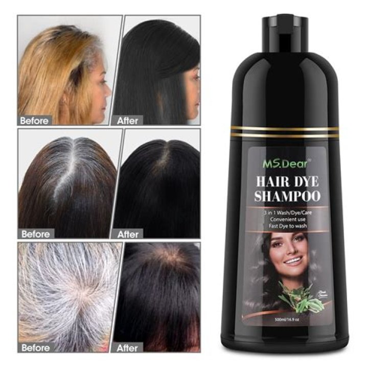 Which vitamin makes your hair black?
