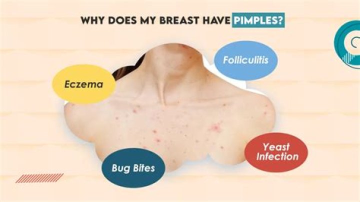Who has pimples in BTS?