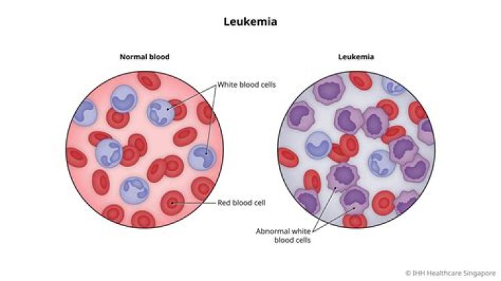 Who is most susceptible to leukemia?