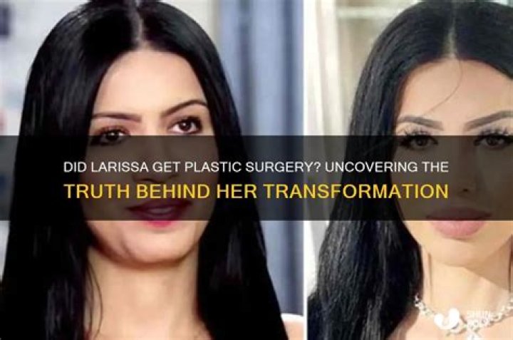 Who paid for Larissa plastic surgery?
