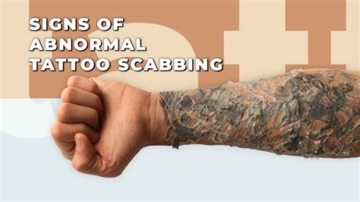 Why am I getting random scabs on my body?