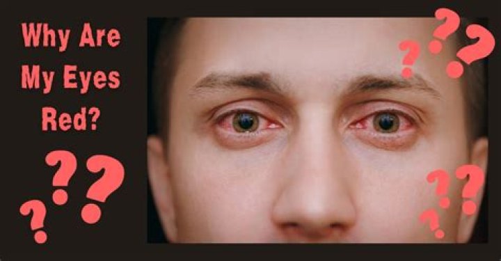 Why are my eyes so dry all the time?