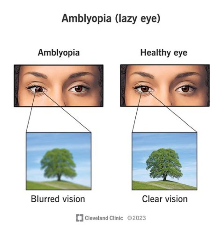 Why can I shake my eyes fast?