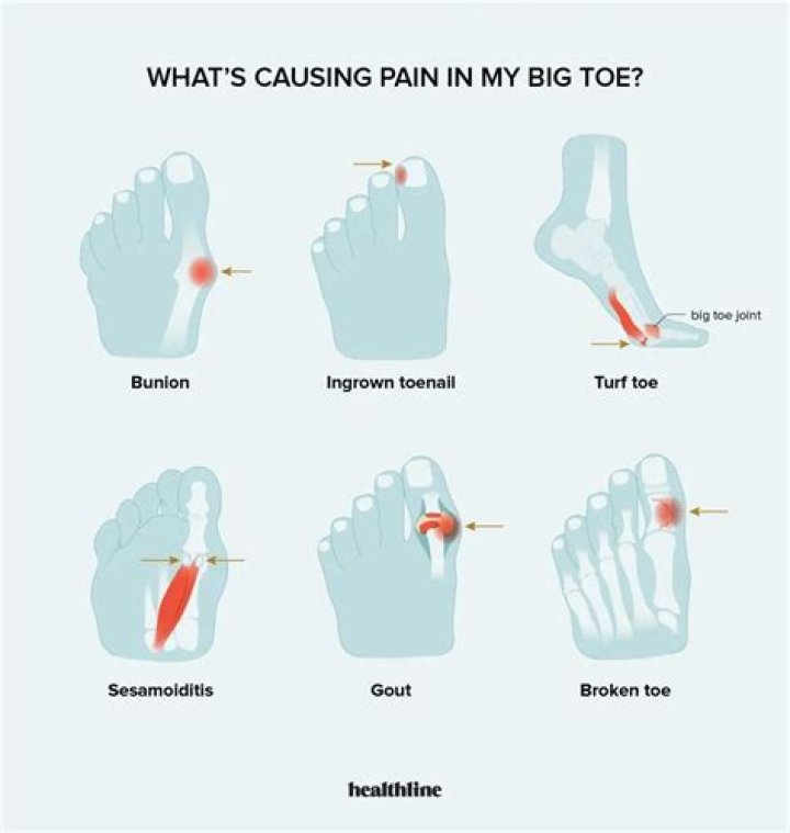 Why can't I bend my big toe upwards?