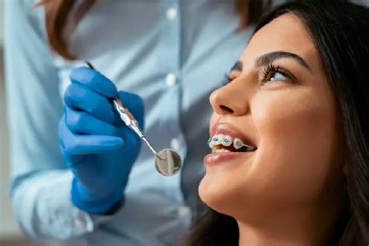Why did my teeth turn yellow after braces?