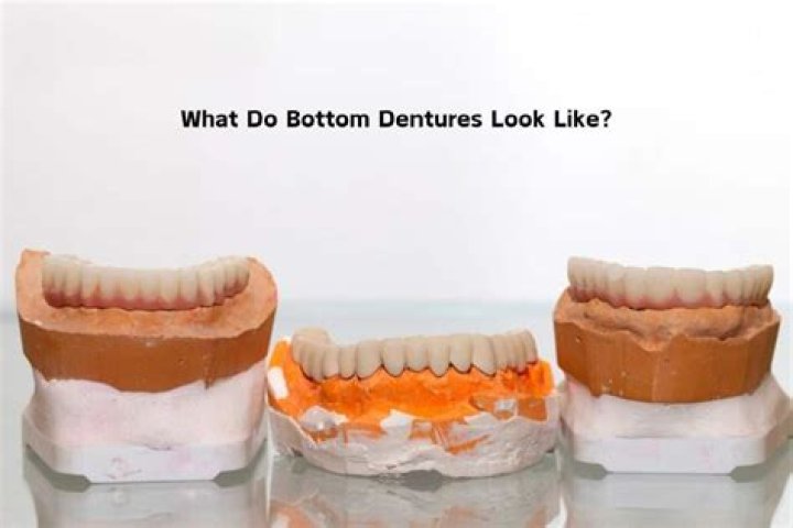 Why do dentures look so big?