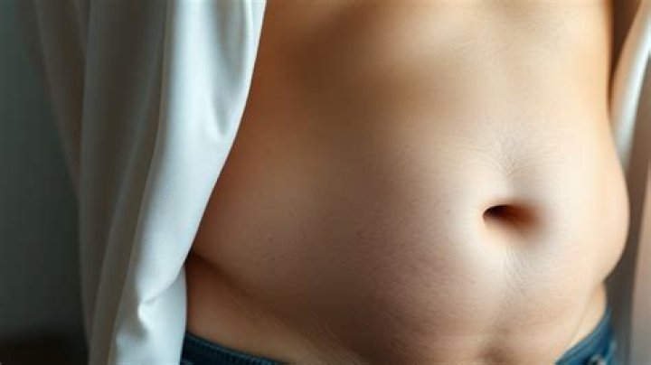 Why do diabetics have large abdomens?