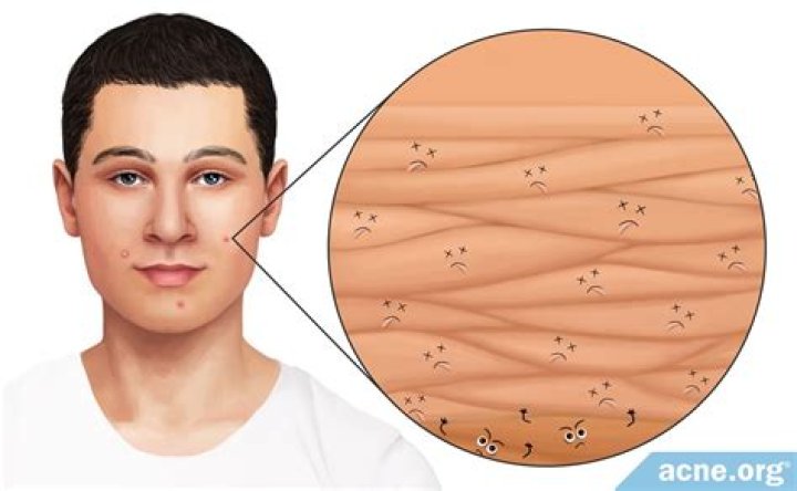 Why do I have so much dead skin on my face?