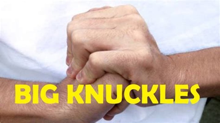 Why do knuckles get bigger with age?