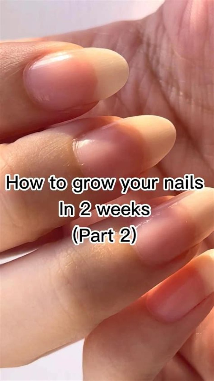 Why do my solar nails lift?