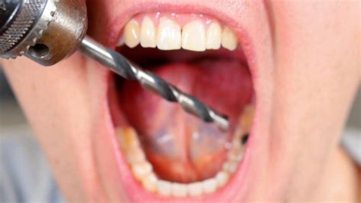 Why do teeth smell when drilling?